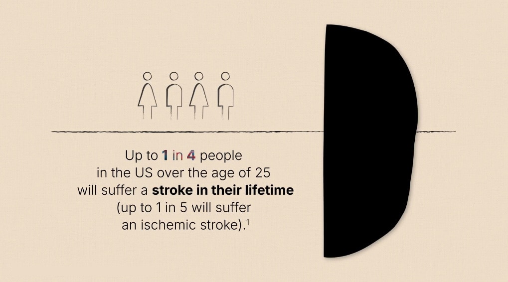 Illustration of 4 outlined people with text: Up to 1 in 4 people in the US over the age of 25 will suffer a stroke in their lifetime (up to 1 in 5 will suffer an ischemic stroke).
